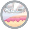 Hydrafacial_Cosmedicpoint_Schritt_3