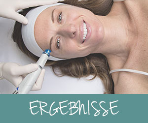 Hydrafacial_Behandlungsergebnisse