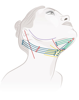 Fadenlifting_Comsedicpoint_Hals