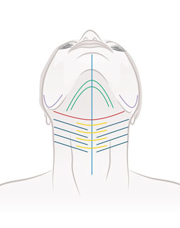 Fadenlifting_Cosmedicpoint_Gratkorn_Halslifting
